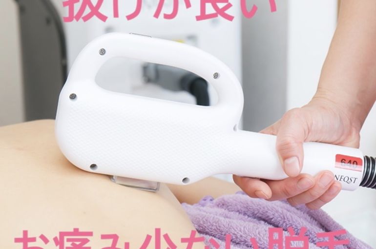脱毛