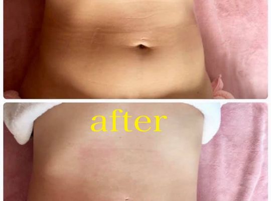 エステ 施術には個人差がございます